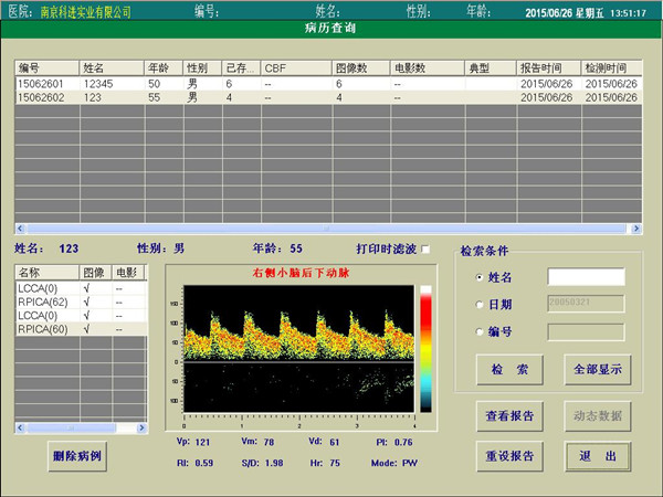 經顱多普勒報告查詢界面.jpg