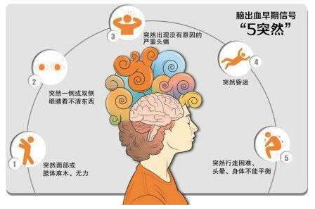 心腦血管病別等發(fā)作才篩查，經顱多普勒TCD超聲檢測心腦血管