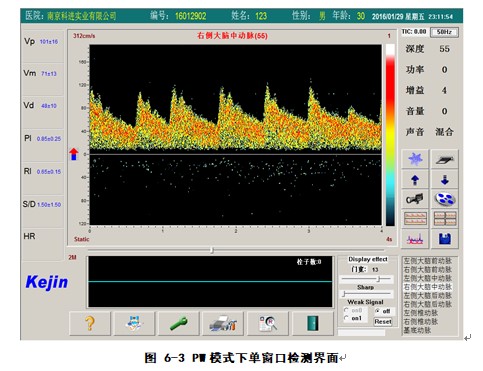 經顱多普勒軟件PW模式下單窗口檢測界面
