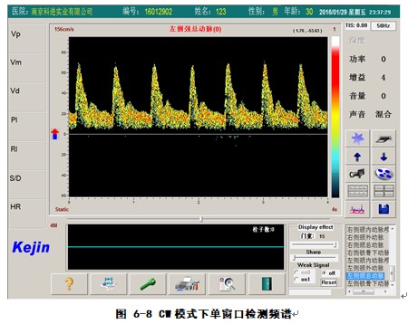 經顱多普勒軟件CW模式下單窗口檢測界面